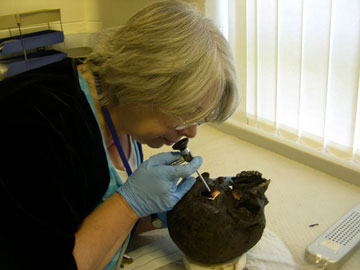 Η δρ Sonia O Connor (Πανεπιστήμιο Bradford) εξετάζει το κρανίο του Heslington.  