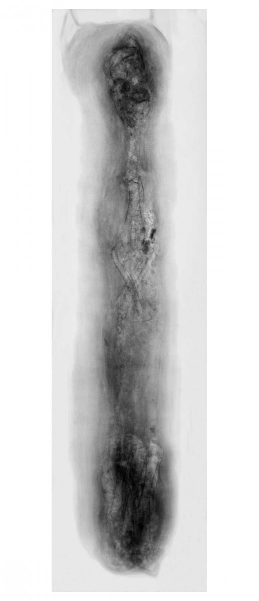 Ακτινογραφία ταριχευμένης γάτας, Εθνικό Αρχαιολογικό Μουσείο.