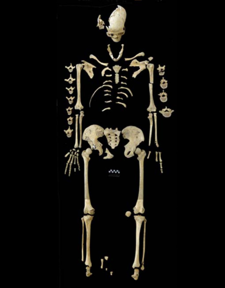 O σκελετός της γυναίκας, που χρονολογείται προ 7.000 ετών και αποκαλύφθηκε στη Γερμανία (φωτ. © M. Francken/Universität Tübingen).