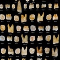 «Μοντέρνα» δόντια ηλικίας 80.000-120.000 ετών βρέθηκαν στην Κίνα