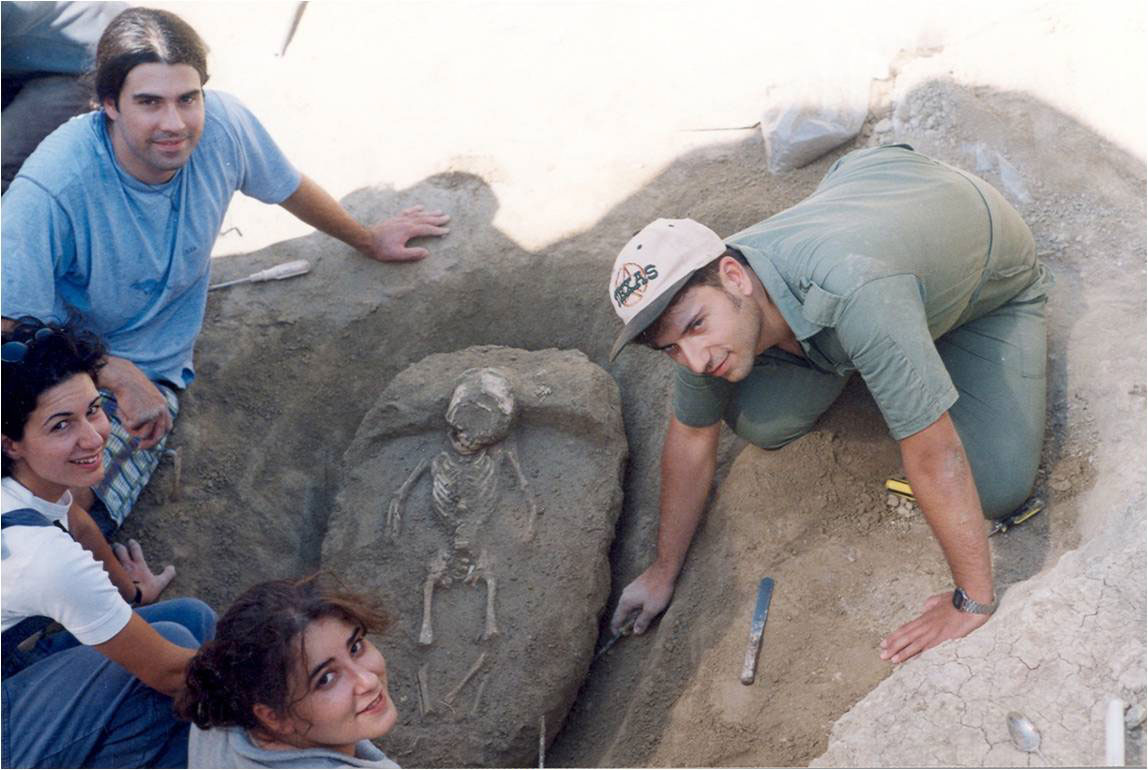 Εικ. 6. Σκελετός μικρού παιδιού, εύρημα στην ανασκαφή της Άνω Κώμης Κοζάνης (1999). Προετοιμασία γύψινου νάρθηκα για την ασφαλή απομάκρυνσή του από το έδαφος.