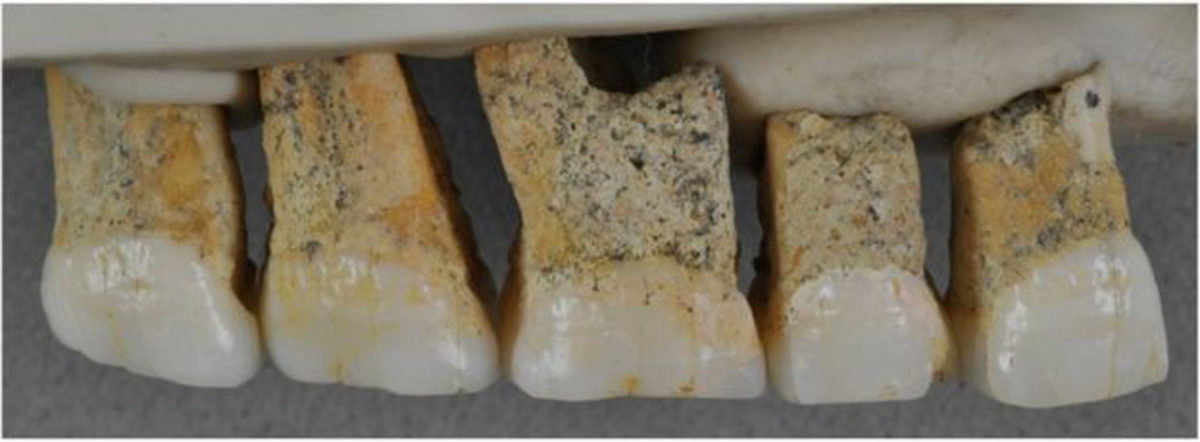 Απολιθωμένα δόντια Homo Luzonensis (φωτ.: Florent Detroit).