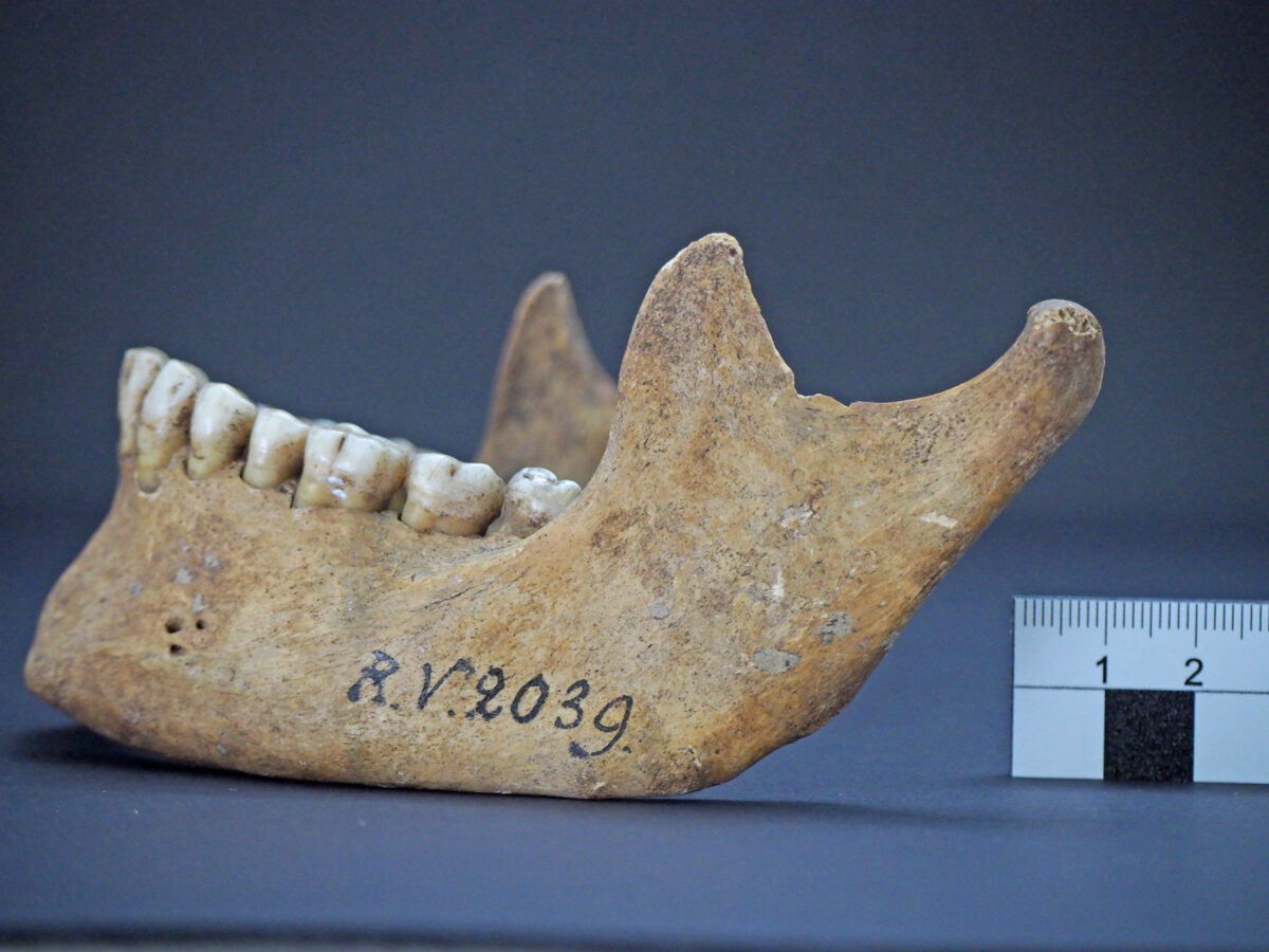 Νεαρός κυνηγός-τροφοσυλλέκτης το πρώτο γνωστό θύμα της πανώλης